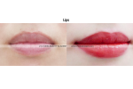 (17) 21c korea feathering micropigmentation, lips
