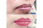(57) Full Lips, Lip Line Micropigmentation